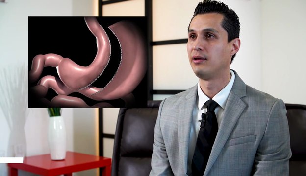 Gastric Sleeve Surgery - Tijuana, Mexico - Monterrey, Mexico