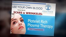 Platelet rich plasma prp treatment | Equinox