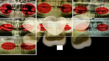 How to brush your teeth Learn in 4 simple steps