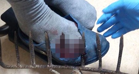 Bahçeyi Temizlerken Üstüne Bastığı Tırmık Yaşlı Adamın Ayağına Saplandı!