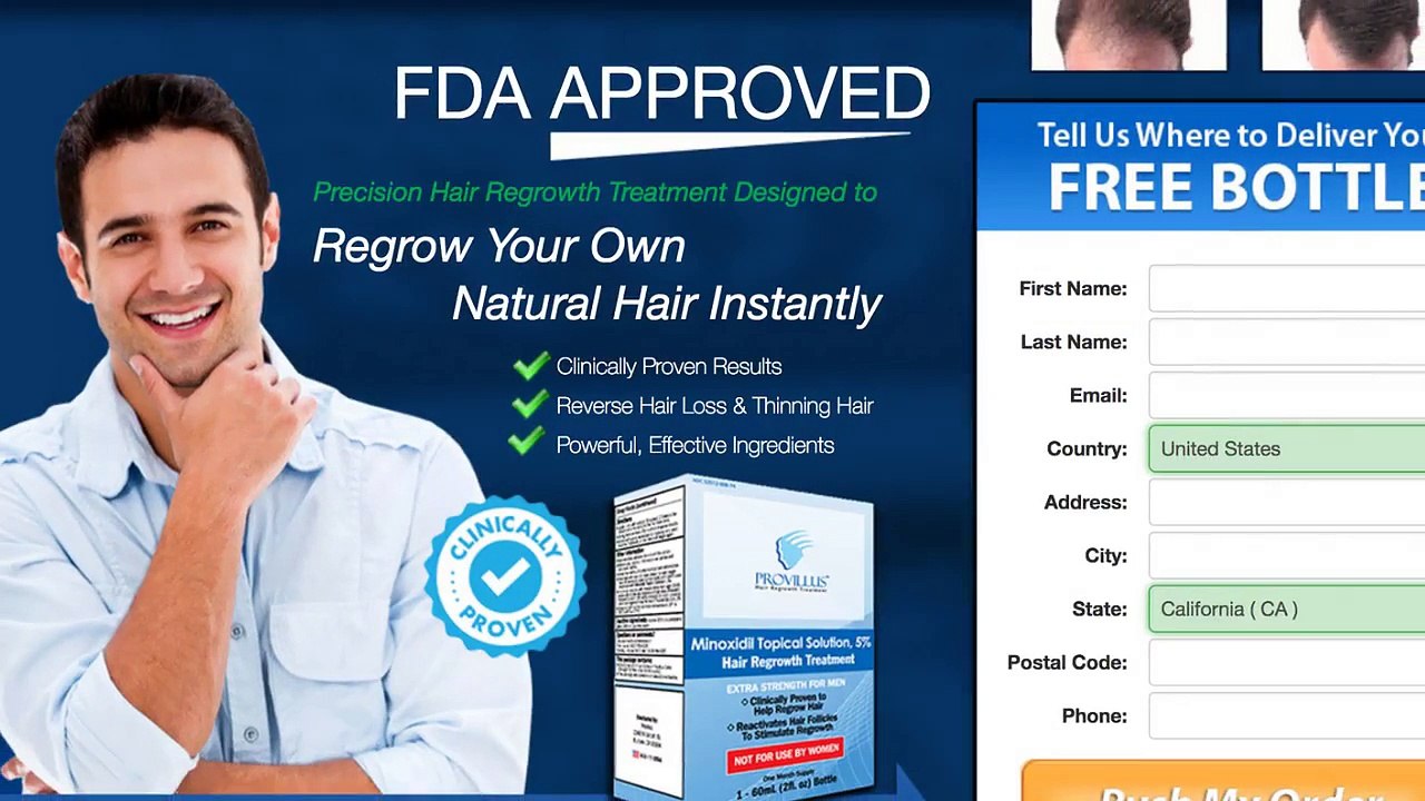 Provillus Reviews ~ An Effective Solution For Hair Loss?