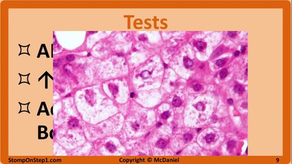 Viral Hepatitis: Hepatitis A, Hepatitis B, Hepatitis C, HBsAg HBeAg Vaccine HCV HBV HBsAb