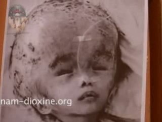 l'agent orange tue encore (VIETNAM-DIOXINE)