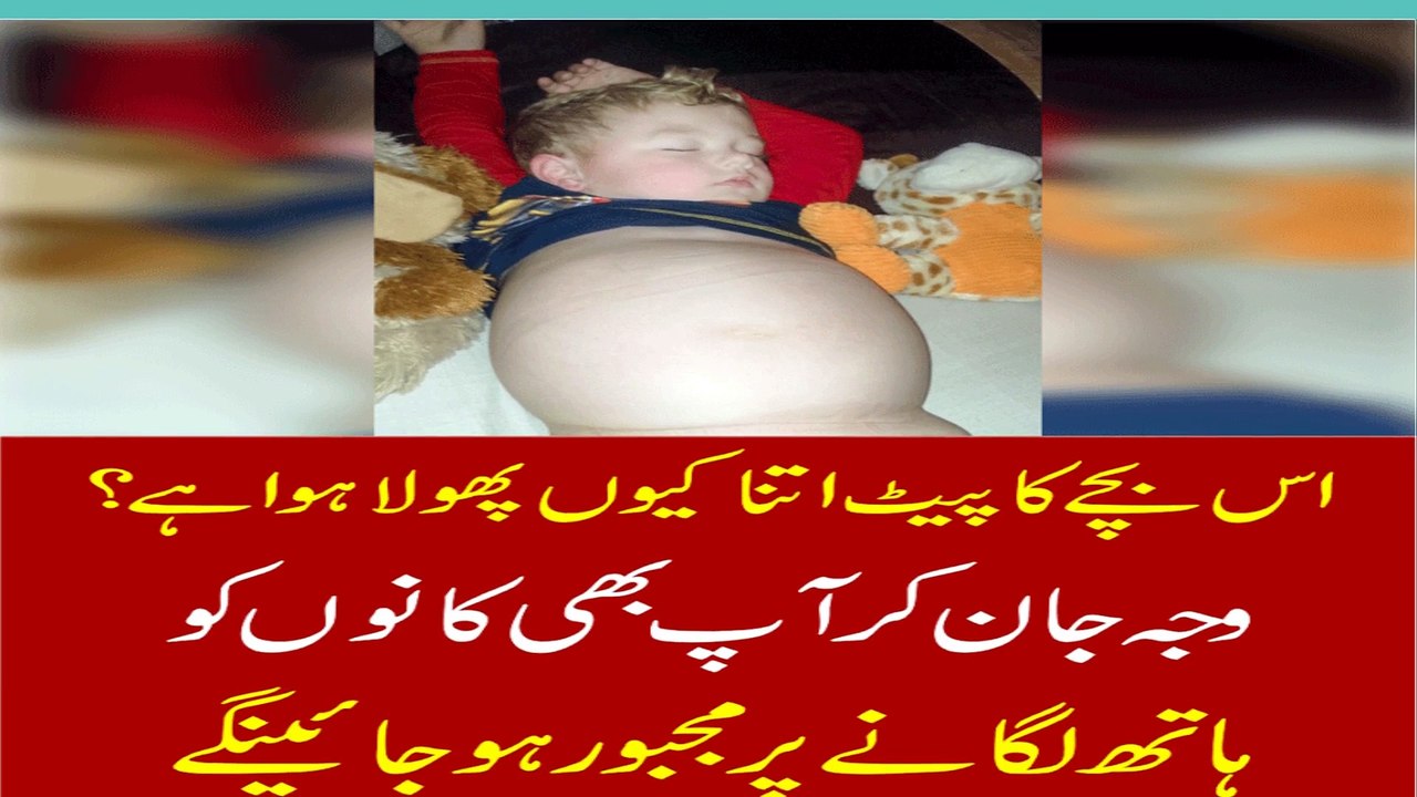Doncaster Boy Has A Condition That Makes Him Look Pregnant