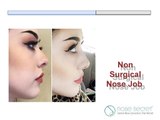 Non Surgical Nose Job - Nose Secret