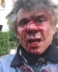 Algérie, FLN, Amar Saâdani (1), son fils tente de Tuer Rachid NEKKAZ,محاولة قتل