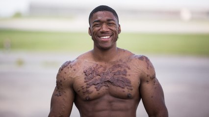 My Scars Won’t Kill My Bodybuilding Dreams | UNBREAKABLE ME