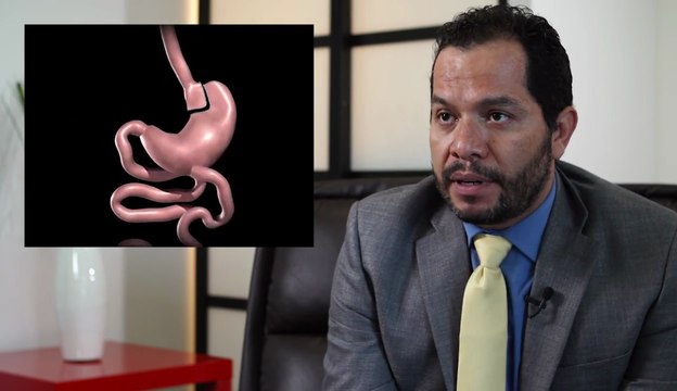 Gastric Bypass - Tijuana, Mexico - Monterrey, Mexico