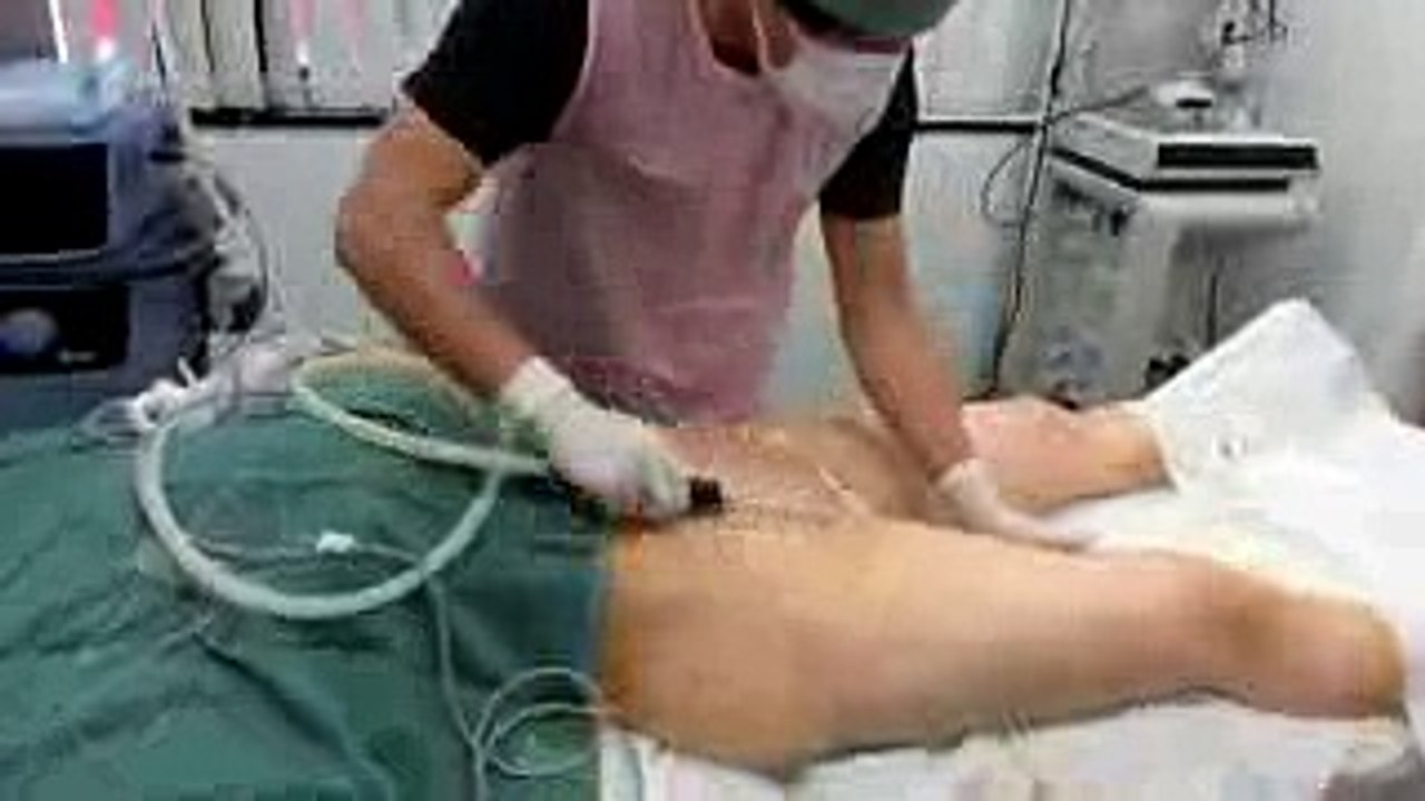 40代 下半身 脂肪吸引③ 名倉俊輔＠湘南美容外科(liposuction japan)