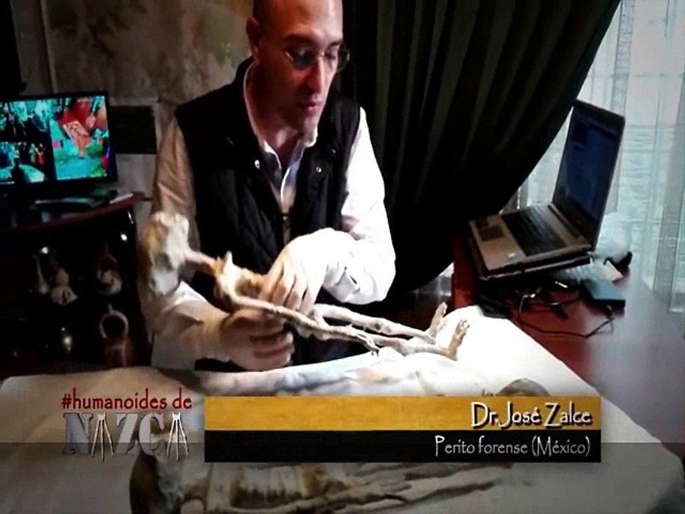 Les Etres mystérieux de Nasca  - Analyse de Josefina ( Dr R. SALAS ALFARO et Dr J. SALCE BENITEZ) - N° 7 - Analyses