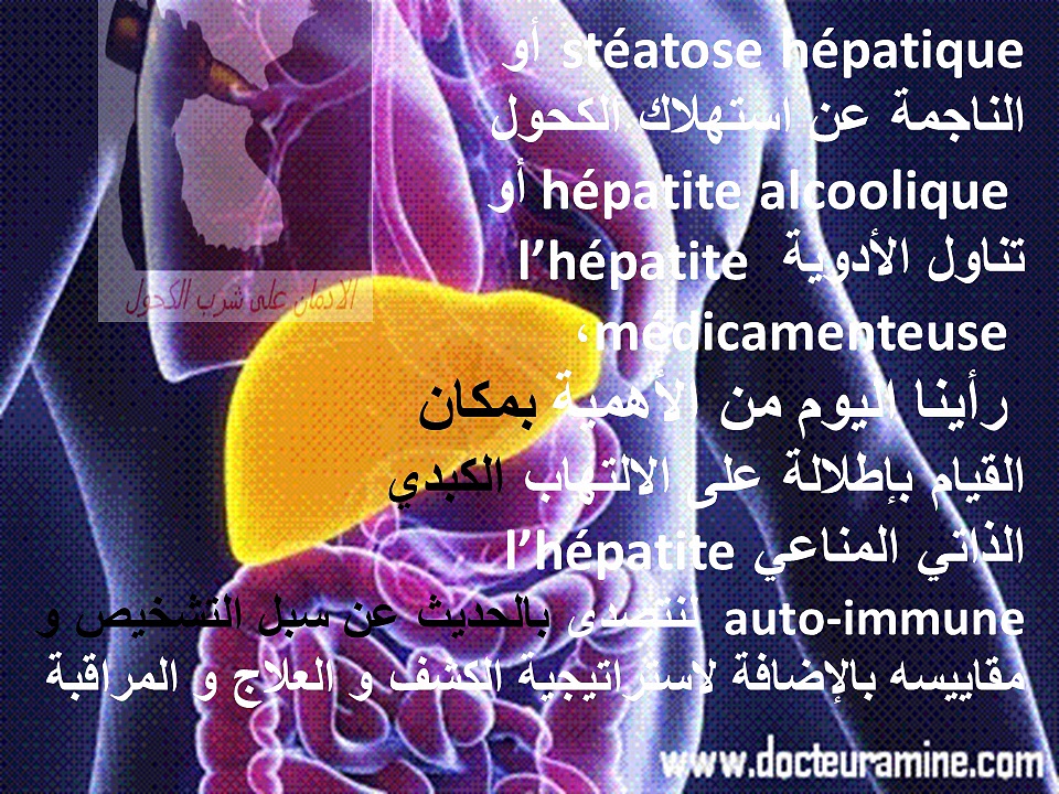 Hépatites auto-immunes الالتهابات الكبدية الذاتية المناعية