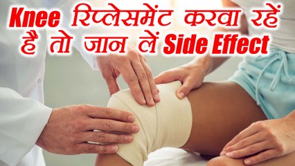 Knee Replacement Surgery करवा रहें है तो जान लें Side Effects | Boldsky