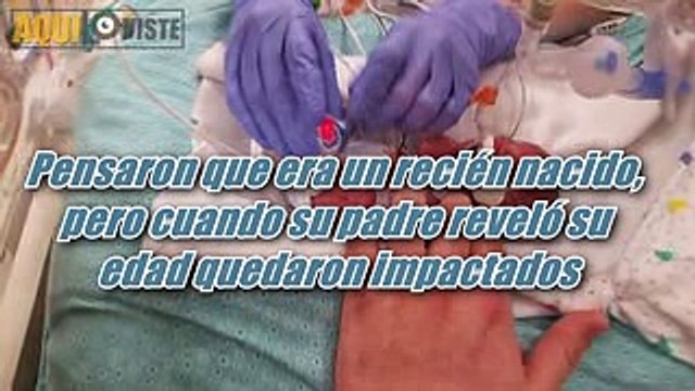 Pensaron que era un recién nacido, Pero cuando su padre reveló su edad quedaron impactados!