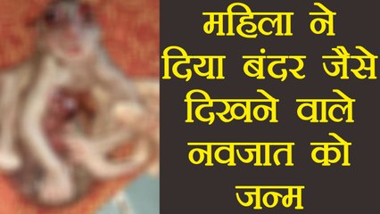 Patna: महिला ने दिया मनुष्य-बंदर जैसे दिखने वाले नवजात को जन्म । वनइंडिया हिंदी