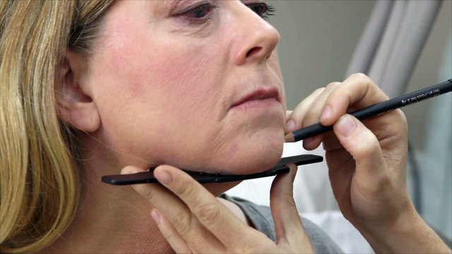 SculpSure FDA Cleared for Submental Lipolysis