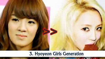 10 Seleb Korea Before And After Oplas