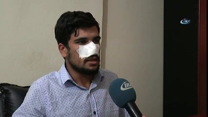 Kavga Ettiği Kuzeninin Burnunu Isırıp Kopardı