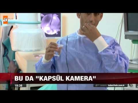 'Casus kamera' devlet hastanelerinde - atv Ana Haber