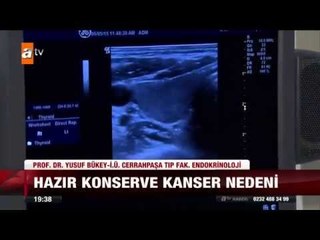 Hazır konserve kanser nedeni - 11.07.2015 - atv