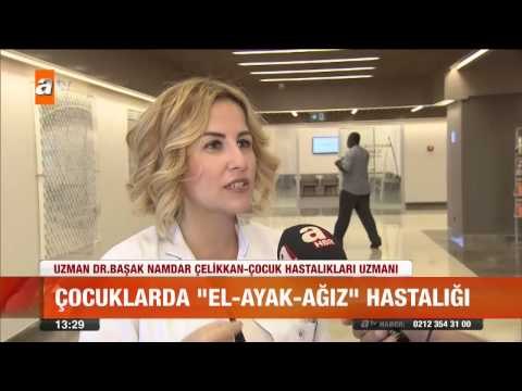 Çocuklarda el - ayak - ağız hastalığı - atv Gün Ortası Bülteni