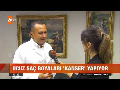 Ucuz saç boyaları zehir saçıyor! - atv Gün Ortası Bülteni
