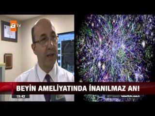 Beyin ameliyatında inanılmaz an! - 10.10.2015 - atv Ana Haber