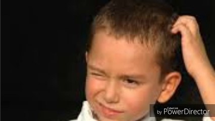 The Natural Remedy !! How to get rid of dandruff