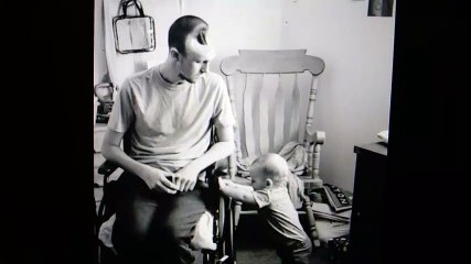 Wife Kisses Husband's Hole In His Head