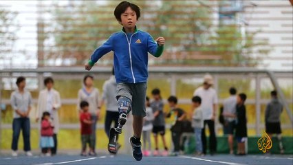 هذا الصباح- مركز باليابان يوفر الأطراف الصناعية بأسعار رمزية