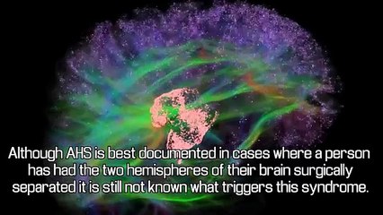 7 Rare Mental Disorders That Will Freak You Out