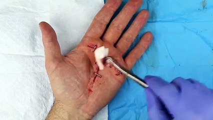 Part 2 of 2 - Hand trauma SFX makeup tutorial (Surgical staples)