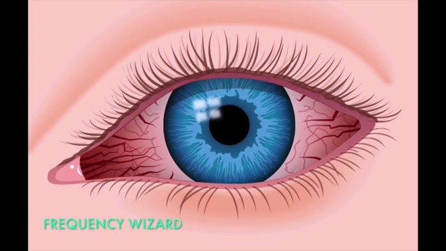 Get Pure White Scleras Fast! Red Eye Recovery Whiter Eyes Treatment Subliminal Subconscious Hypnosis