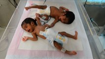 L’Inde a le record mondial du nombre de décès de nouveaux-nés