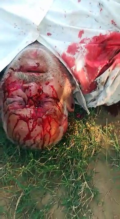 Traffic accident in Feroz-Pur Road