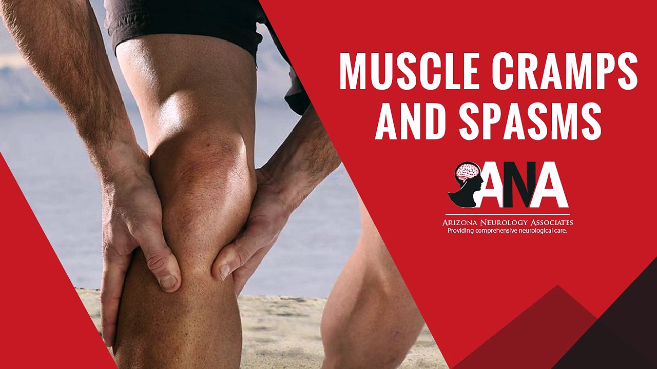 Arizona Neurology Associates - Muscle Cramps and Spasms