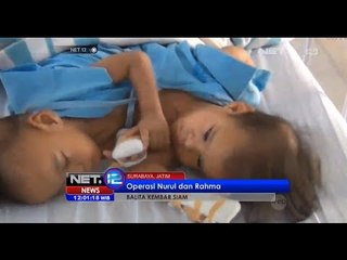 Download Video: NET12 - Balita kembar siam di RS Dokter Sutomo Surabaya jalani proses operasi pemisahan