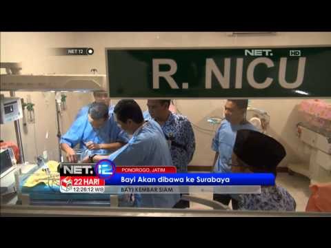 NET12 Bayi Kembar Siam Ponorogo Siap Jalani Operasi Pemisahan