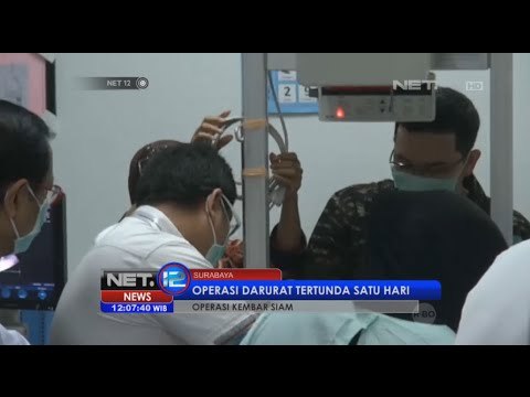 Bayi kembar siam Aldi dan Aldo jalani operasi pemisahan di RSUD Dokter Soetomo Surabaya - NET12