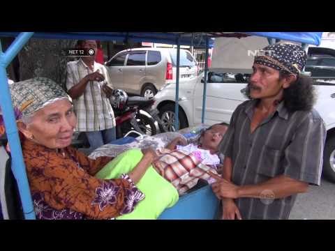 Penderita Hidrosefalus di Padang Keliling Kota - NET12