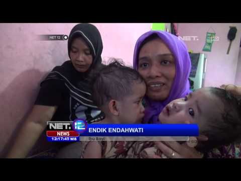 Bayi kembar siam di Kediri kini dirawat di rumah karena kurangnya biaya - NET12