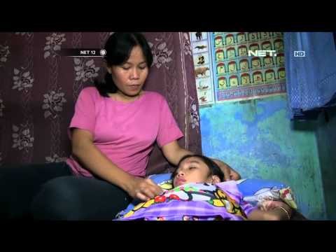 Bocah 8 Tahun di Depok Derita Penyakit Langka - NET12