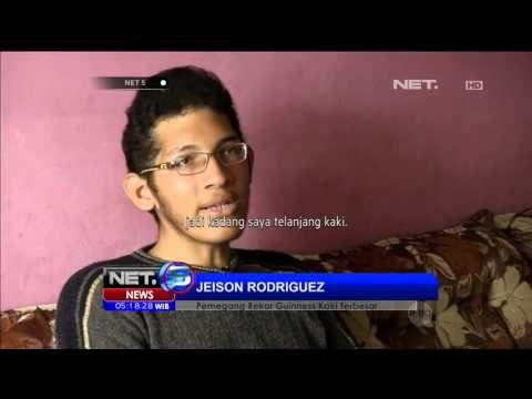 Seorang Warga Venezuela Pecahkan Rekor Kaki Terbesar di Dunia - NET5