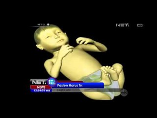 Tanggapan Dokter Terkait Penyakit Atresia Bileria - NET12