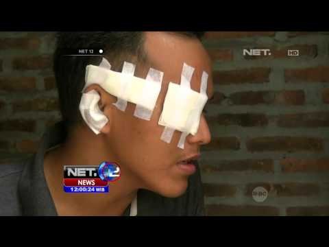 Mata Asisten Masini Terkena Lemparan Batu - NET 12