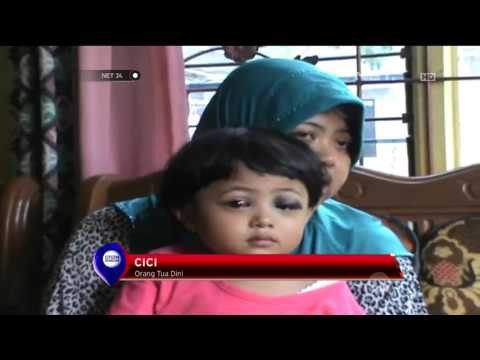 Dampak Kabut Asap, Seorang Balita di Riau Alami Batuk Rejan - NET24