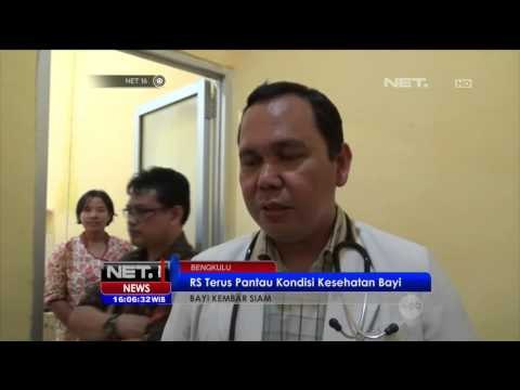 Kisah Bayi Kembar Siam Dempet Perut Lahir di Bengkulu - NET16