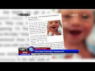 Viral Media Sosial Foto Bayi Prematur Tersenyum - NET 12