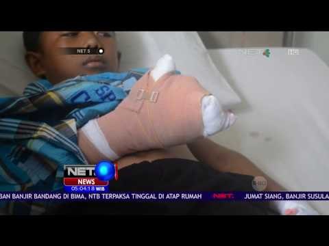 Bocah 10 Tahun Jadi Korban Ledakan Kembang Api – NET5