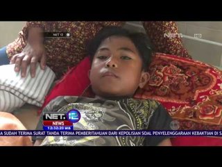 Korban Ledakan Bom Ikan Masih Menjalani Perawatan di Jember Jawa Timur - NET 12