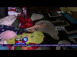 Alami Meningitis Sejak Usia Setahun, Aftaria Hanya Berbobot 14 Kg - NET12